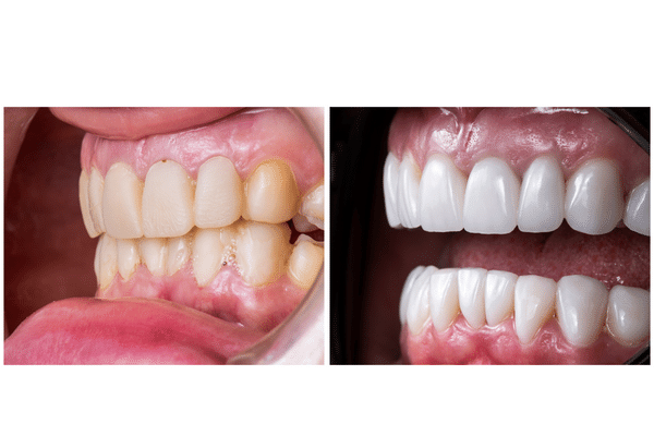 cirugia odontologica en Algeciras por colvi dental