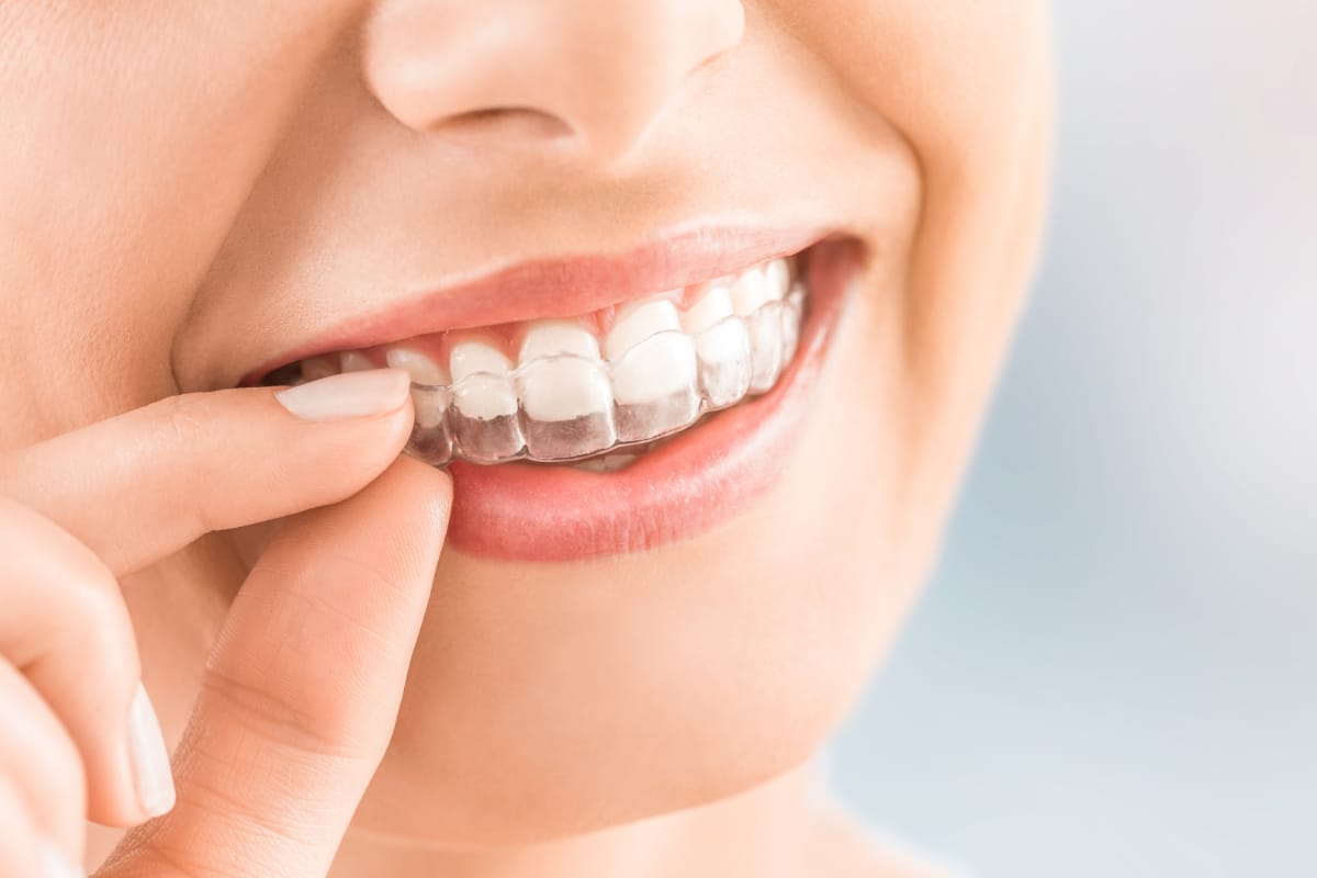 tratamientos dentales en Colvi, clinica dental en Algeciras